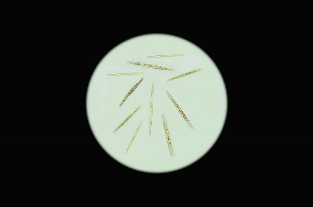 microscope view of harmful algea
